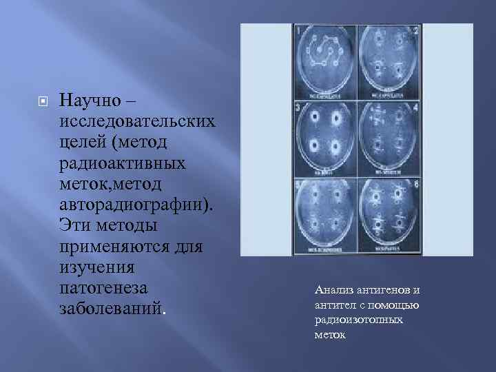  Научно – исследовательских целей (метод радиоактивных меток, метод авторадиографии). Эти методы применяются для