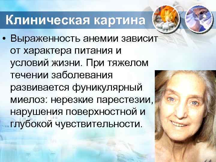 Клиническая картина • Выраженность анемии зависит от характера питания и условий жизни. При тяжелом