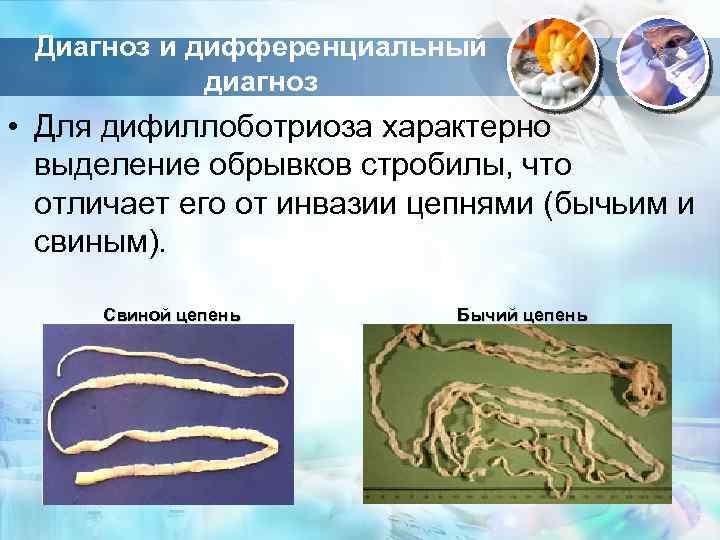 Диагноз и дифференциальный диагноз • Для дифиллоботриоза характерно выделение обрывков стробилы, что отличает его