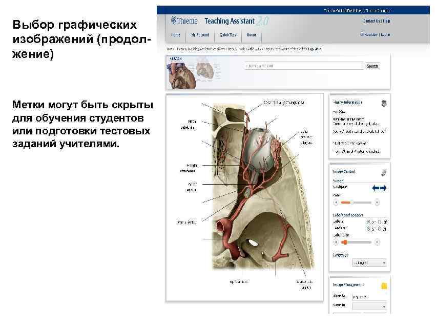 Выбор графических изображений (продолжение) Метки могут быть скрыты для обучения студентов или подготовки тестовых