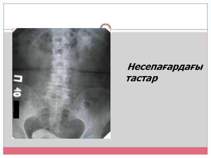 Несепағардағы тастар 