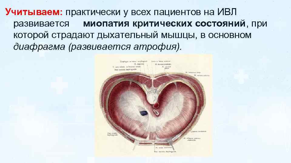 Учитываем: практически у всех пациентов на ИВЛ развивается миопатия критических состояний, при которой страдают