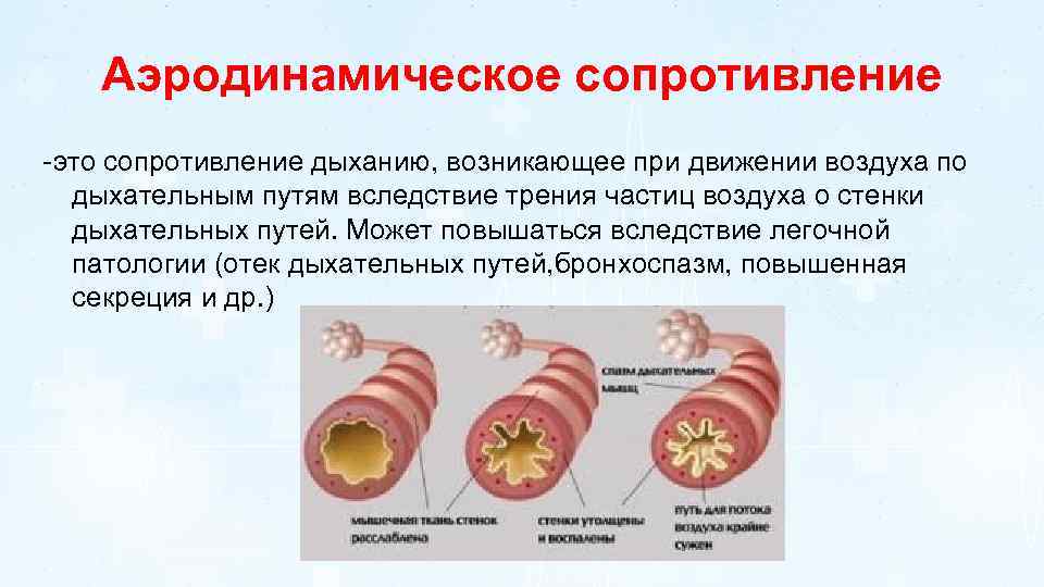 Аэродинамическое сопротивление -это сопротивление дыханию, возникающее при движении воздуха по дыхательным путям вследствие трения