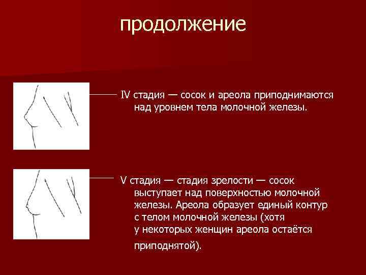 продолжение IV стадия — сосок и ареола приподнимаются над уровнем тела молочной железы. V