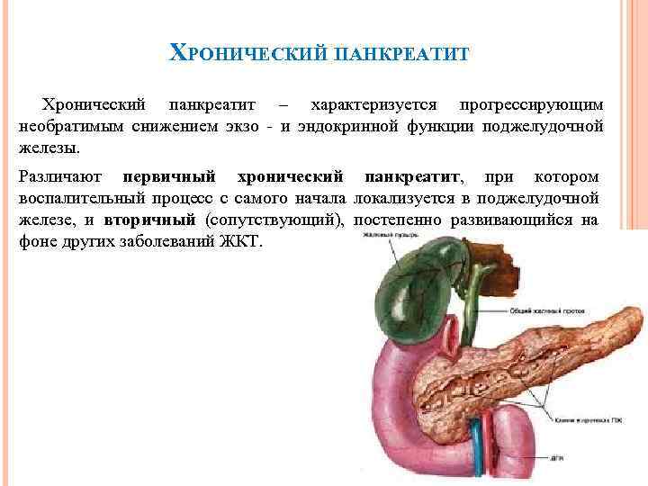 ХРОНИЧЕСКИЙ ПАНКРЕАТИТ Хронический панкреатит – характеризуется прогрессирующим необратимым снижением экзо - и эндокринной функции