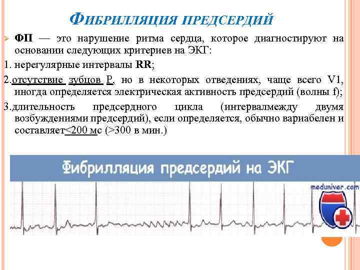 ФИБРИЛЛЯЦИЯ ПРЕДСЕРДИЙ ФП — это нарушение ритма сердца, которое диагностируют на основании следующих критериев