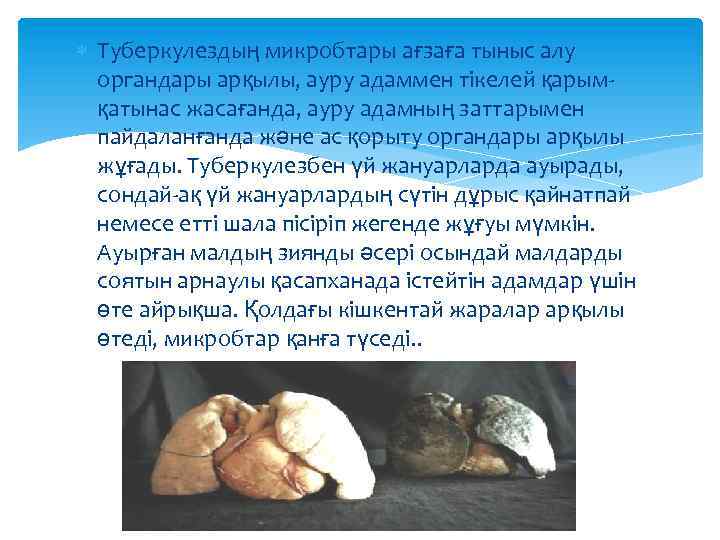  Туберкулездың микробтары ағзаға тыныс алу органдары арқылы, ауру адаммен тікелей қарымқатынас жасағанда, ауру