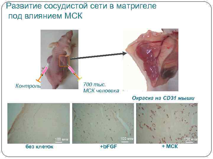 Развитие сосудистой сети в матригеле под влиянием МСК 700 тыс. МСК человека Контроль Окраска