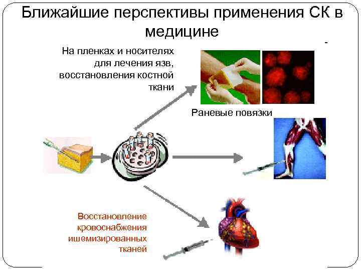 Ближайшие перспективы применения СК в медицине На пленках и носителях для лечения язв, восстановления