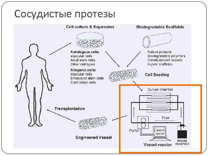 Сосудистые протезы 