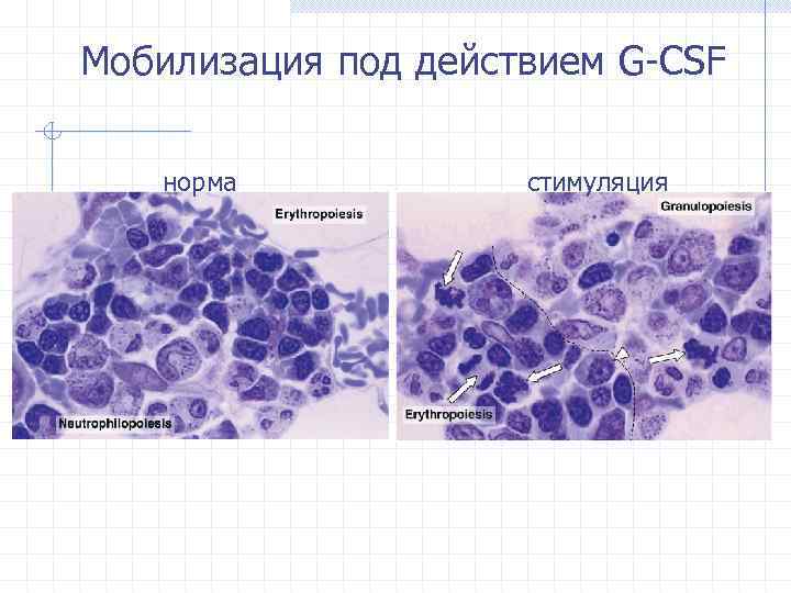 Мобилизация под действием G-CSF норма стимуляция 