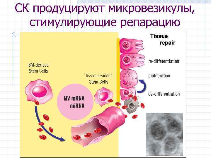 СК продуцируют микровезикулы, стимулирующие репарацию 