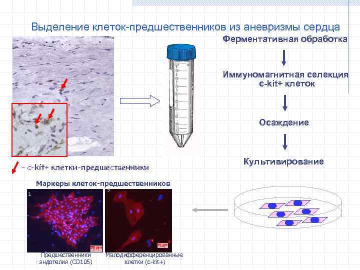 Выделение клеток-предшественников из аневризмы сердца Ферментативная обработка Иммуномагнитная селекция c-kit+ клеток Осаждение - с-kit+