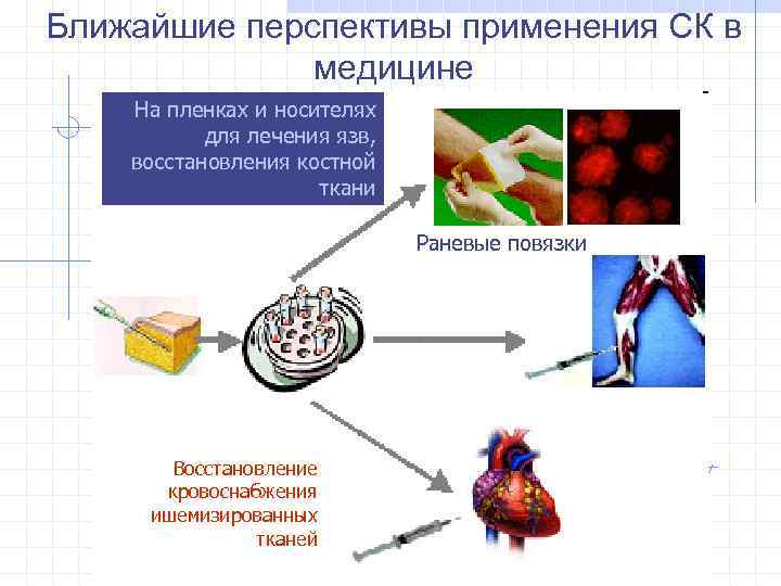 Ближайшие перспективы применения СК в медицине На пленках и носителях для лечения язв, восстановления