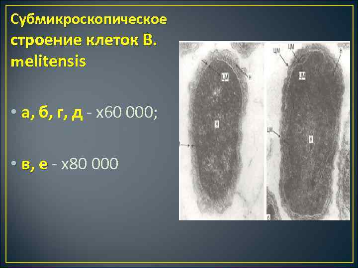 Субмикроскопическое строение клеток В. melitensis • а, б, г, д х60 000; • в,