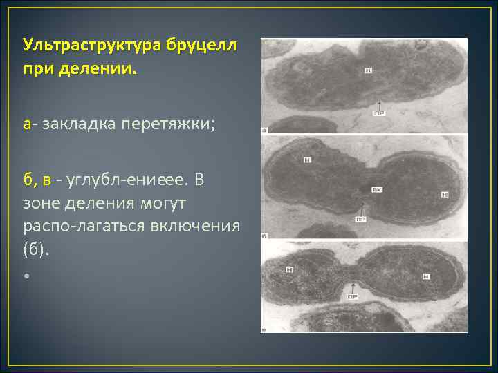 Ультраструктура бруцелл при делении. а закладка перетяжки; б, в углубл ение е. В е