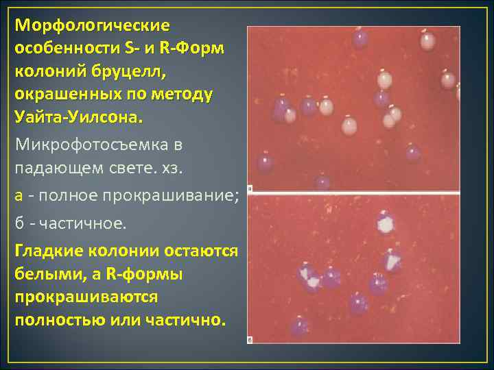 Морфологические особенности S и R Форм колоний бруцелл, окрашенных по методу Уайта Уилсона. Микрофотосъемка