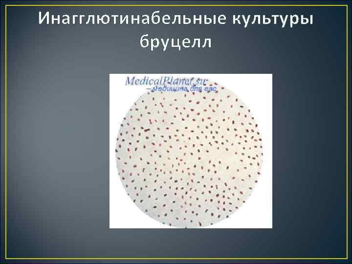 Инагглютинабельные культуры бруцелл 
