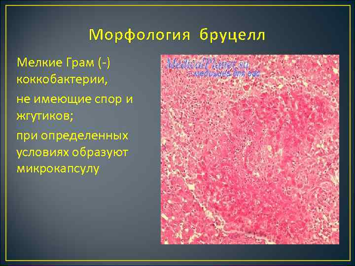 Морфология бруцелл Мелкие Грам ( ) коккобактерии, не имеющие спор и жгутиков; при определенных