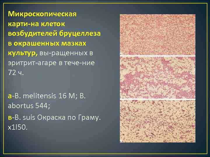 Микроскопическая карти на клеток возбудителей бруцеллеза в окрашенных мазках культур, вы ращенных в культур,