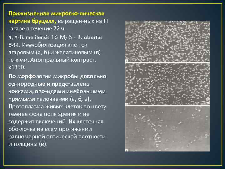 Прижизненная микроско пическая картина бруцелл, выращен ных на FГ агаре в течение 72 ч.
