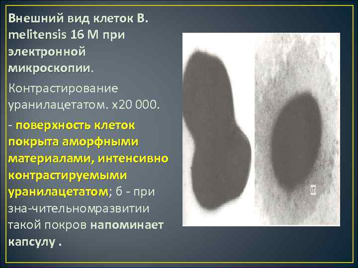 Внешний вид клеток В. melitensis 16 М при электронной микроскопии Контрастирование уранилацетатом. х20 000.