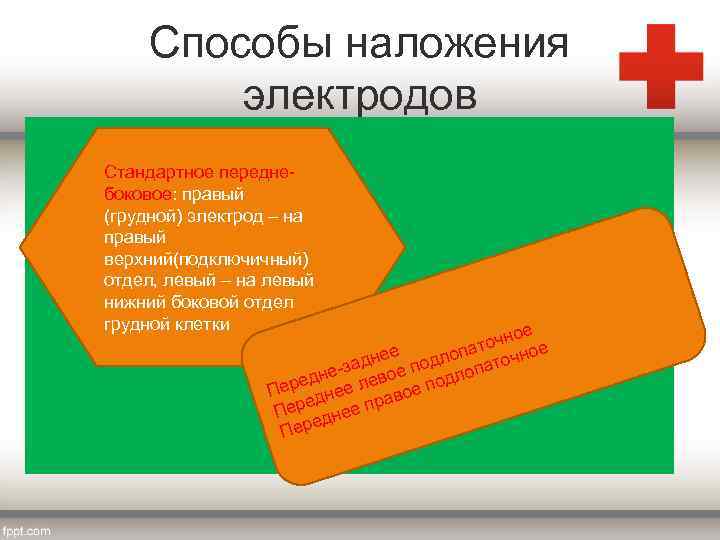 Способы наложения электродов Стандартное переднебоковое: правый (грудной) электрод – на правый верхний(подключичный) отдел, левый