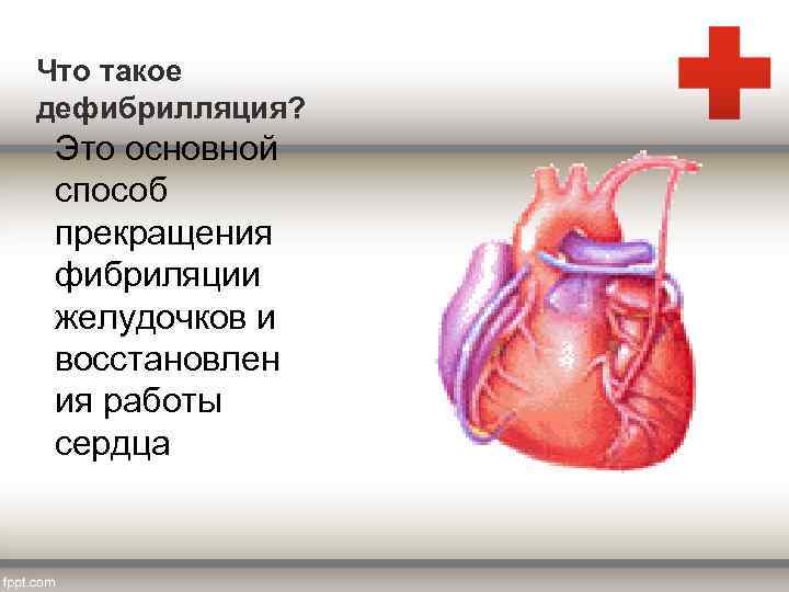 Что такое дефибрилляция? Это основной способ прекращения фибриляции желудочков и восстановлен ия работы сердца