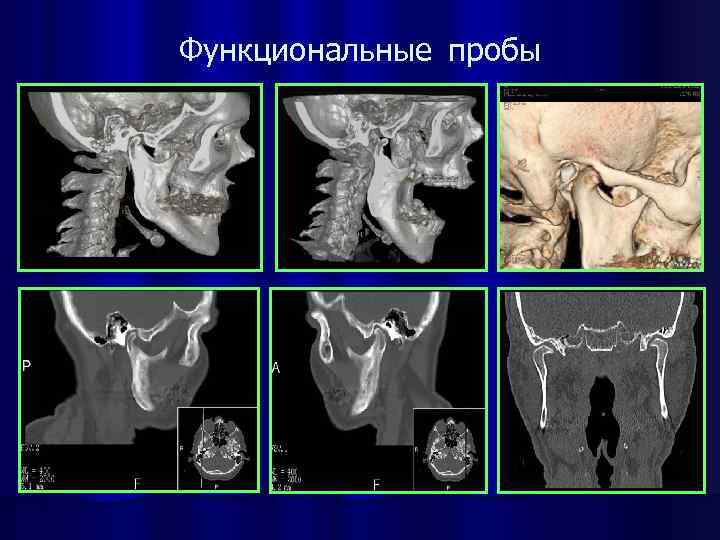 Функциональные пробы 