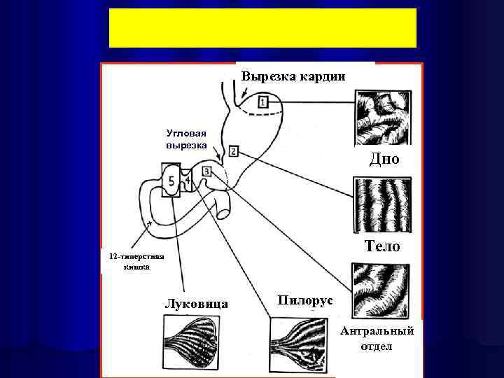 Вырезка кардии Угловая вырезка Дно Тело 12 -типерстная кишка Луковица Пилорус Антральный отдел 