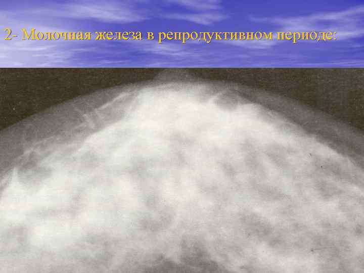2 - Молочная железа в репродуктивном периоде: 