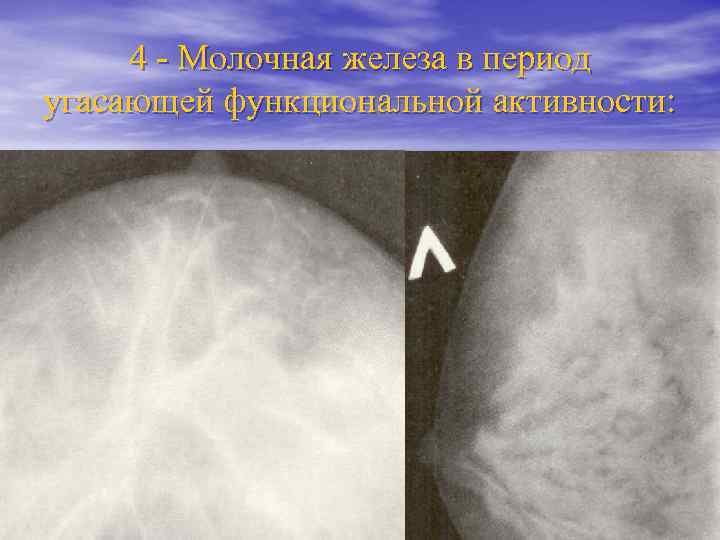 Лучевая анатомия семиотика