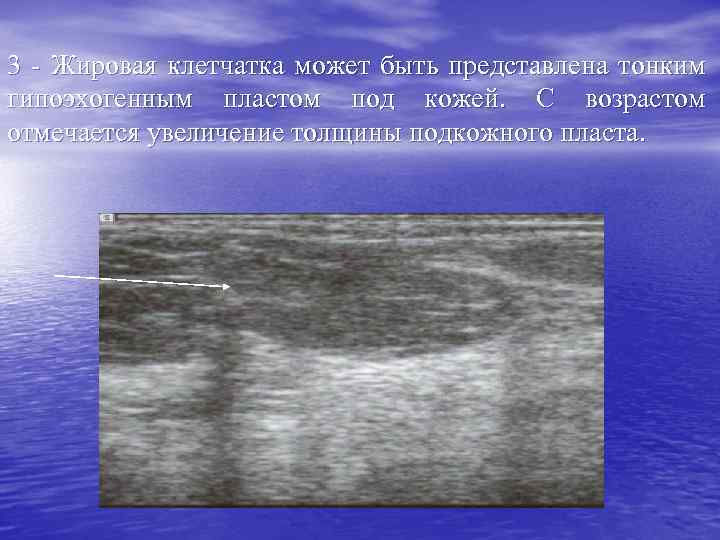 Лучевая анатомия семиотика