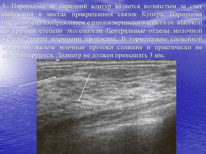 5 - Паренхима, ее передний контур является волнистым за счет выбухания в местах прикрепления