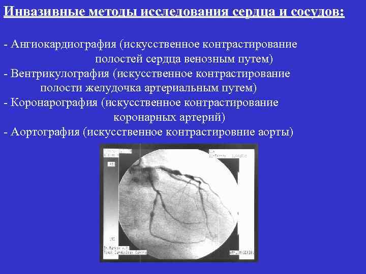 Инвазивные методы исследования сердца и сосудов: - Ангиокардиография (искусственное контрастирование полостей сердца венозным путем)