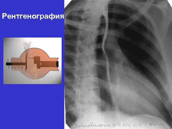 Рентгенография 