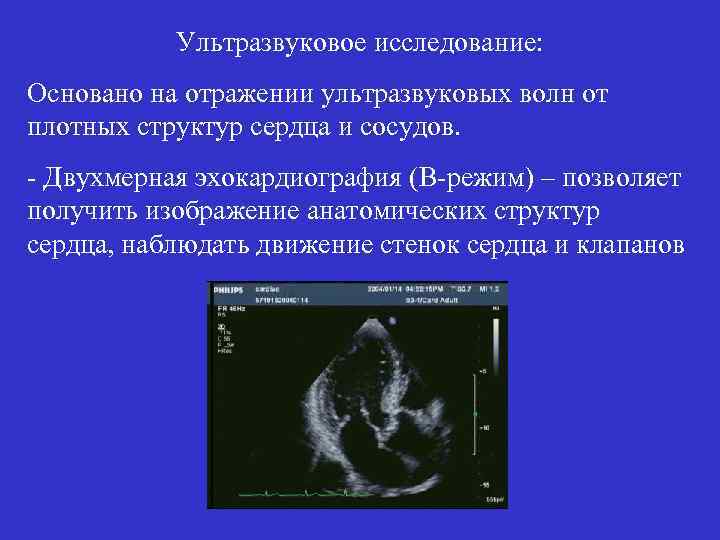 Ультразвуковое исследование: Основано на отражении ультразвуковых волн от плотных структур сердца и сосудов. -