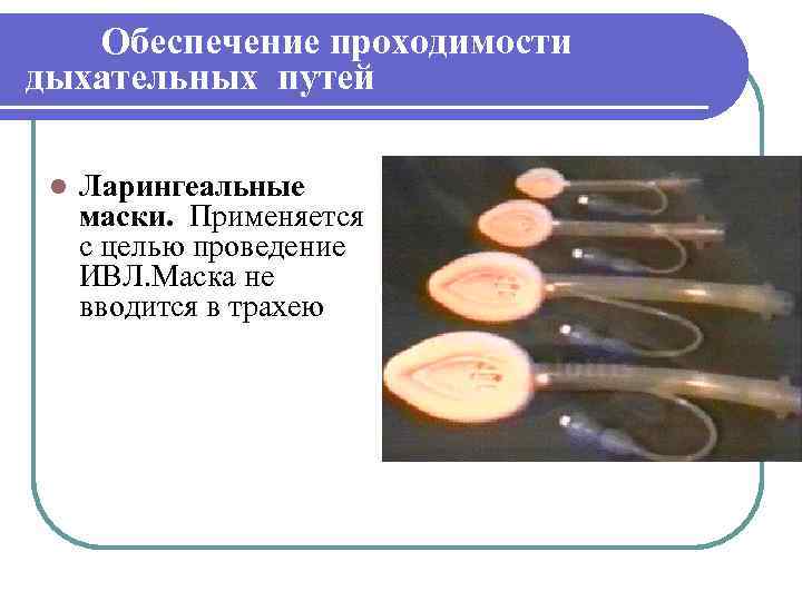 Обеспечение проходимости дыхательных путей l Ларингеальные маски. Применяется с целью проведение ИВЛ. Маска не