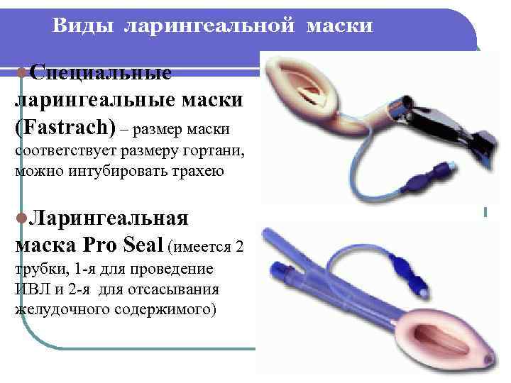 Виды ларингеальной маски l. Специальные ларингеальные маски (Fastrach) – размер маски соответствует размеру гортани,