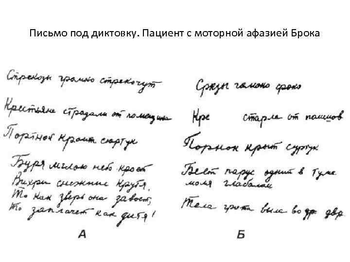 Письмо под диктовку. Пациент с моторной афазией Брока 