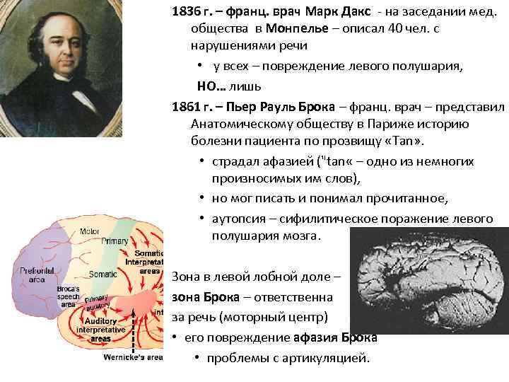 1836 г. – франц. врач Марк Дакс - на заседании мед. общества в Монпелье