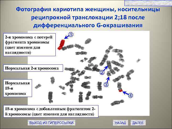 Транслокация хромосом фото