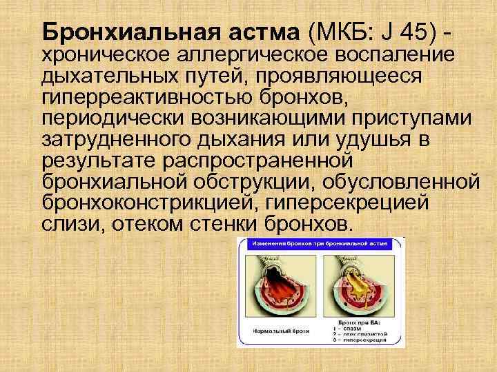 Бронхиальная астма (МКБ: J 45) - хроническое аллергическое воспаление дыхательных путей, проявляющееся гиперреактивностью бронхов,