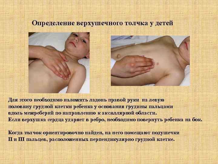 Определение верхушечного толчка у детей Для этого необходимо наложить ладонь правой руки на левую
