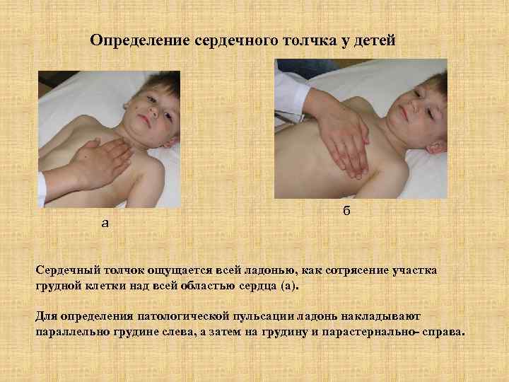 Определение сердечного толчка у детей а б Сердечный толчок ощущается всей ладонью, как сотрясение