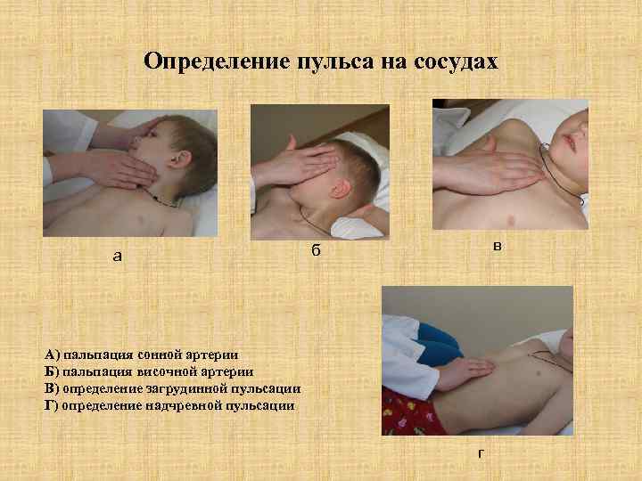 Определение пульса на сосудах а в б А) пальпация сонной артерии Б) пальпация височной