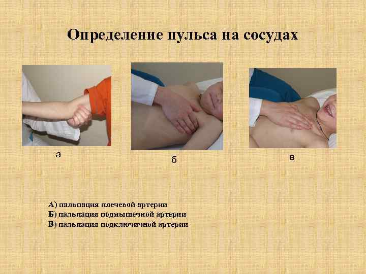 Определение пульса на сосудах а б А) пальпация плечевой артерии Б) пальпация подмышечной артерии