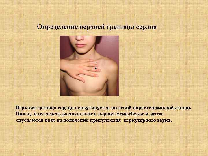 Определение верхней границы сердца Верхняя граница сердца перкутируется по левой парастернальной линии. Палец- плессиметр