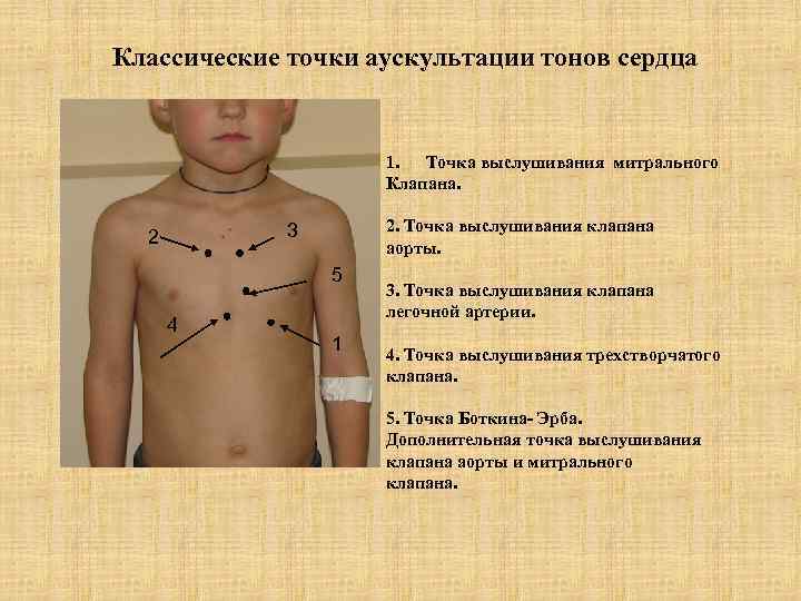 Место выслушивания митрального клапана