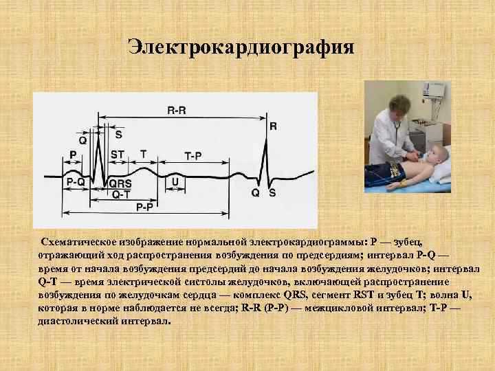 Электрокардиография Схематическое изображение нормальной электрокардиограммы: Р — зубец, отражающий ход распространения возбуждения по предсердиям;